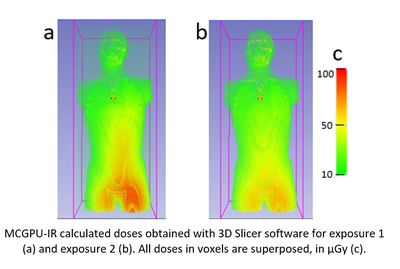 Fast Monte Carlo codes for occupational dosimetry in interventional radiology