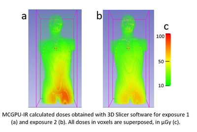 Códigos rápidos de simulación Monte Carlo: PENELOPE/penEasyIR y MCGPU-IR para el cálculo de dosis equivalente personal en operador en radiología intervencionista